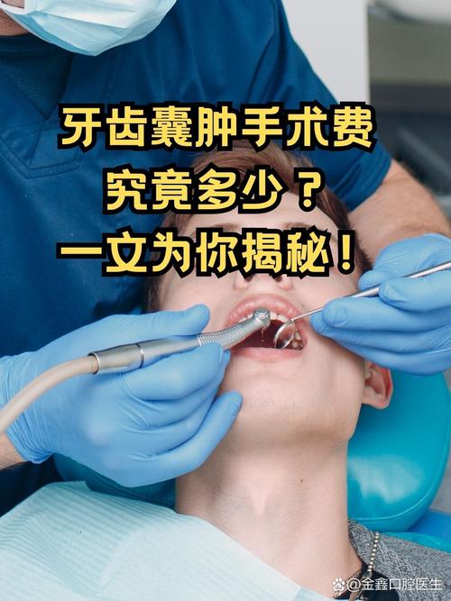 口腔囊肿如何治疗方法-图2