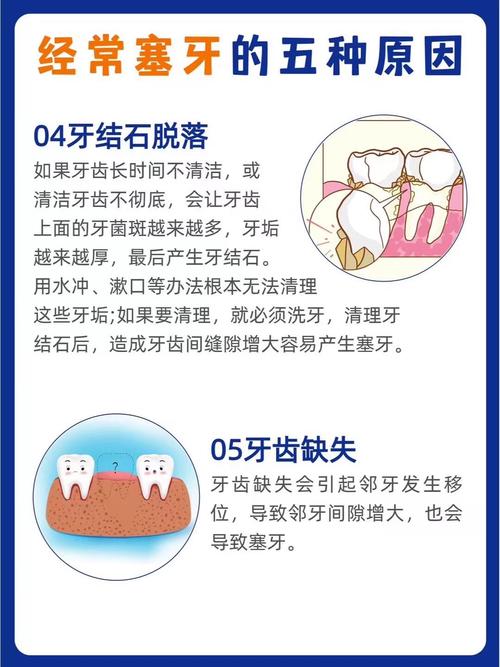 假牙塞牙几种方法解决-图1 假牙塞牙几种方法解决-图1
