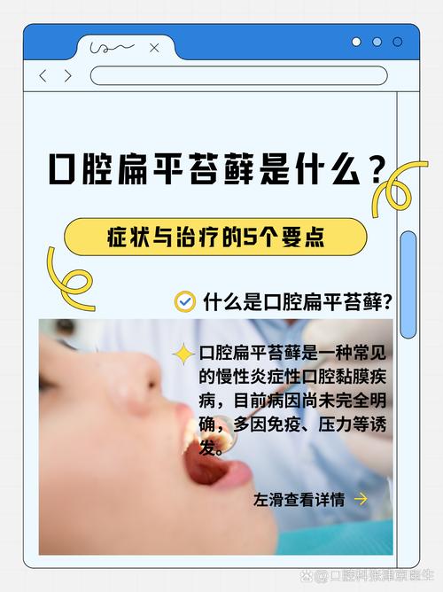 口腔遗传病有哪些有效的治疗方法?-图3 口腔遗传病有哪些有效的治疗方法?-图3