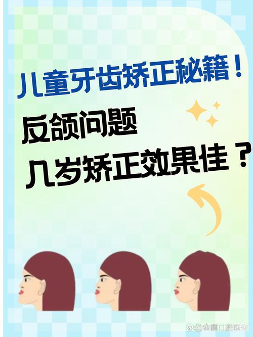 儿童严重反颌矫治方法有哪些?如何科学选择以确保效果?-图1 儿童严重反颌矫治方法有哪些?如何科学选择以确保效果?-图1