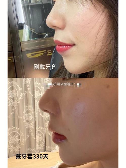 天津市正畸进修生招聘,报名条件与流程是什么?-图2 天津市正畸进修生招聘,报名条件与流程是什么?-图2