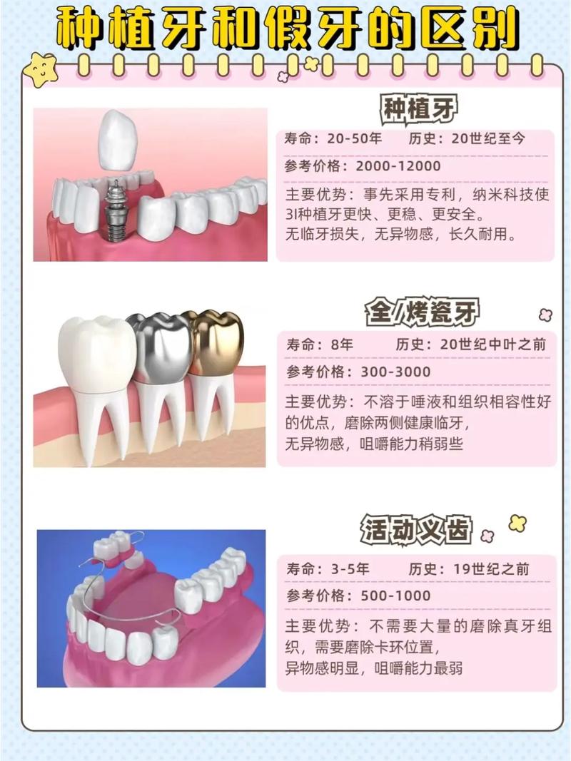 种牙和镶牙有何不同?优缺点、价格及适用场景区别是什么?-图2 种牙和镶牙有何不同?优缺点、价格及适用场景区别是什么?-图2