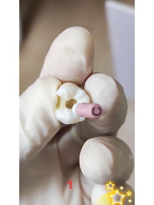 牙科修复自凝树脂的方法是什么?操作要点和注意事项有哪些?-图2 牙科修复自凝树脂的方法是什么?操作要点和注意事项有哪些?-图2