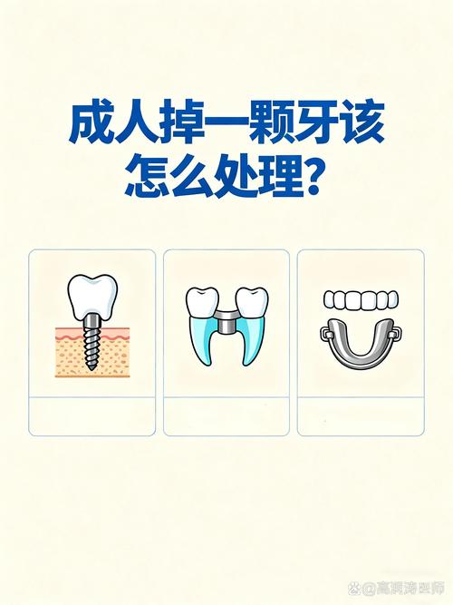 成人牙齿断了怎么办？紧急处理与就医方法有哪些？-图2
