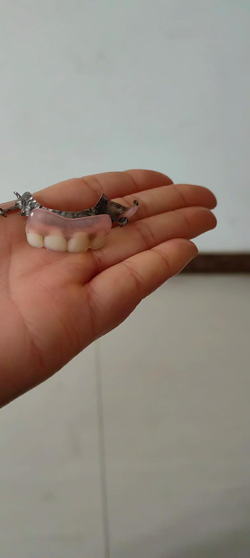 拔牙之后三个月种牙-图3 拔牙之后三个月种牙-图3