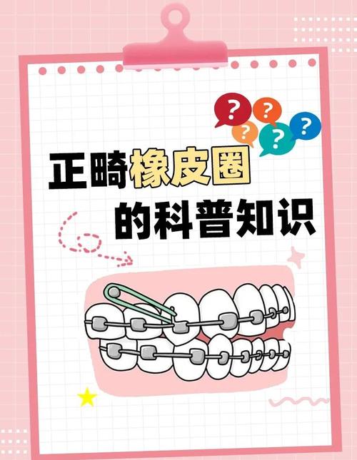 正畸橡皮圈一天带多久-图1 正畸橡皮圈一天带多久-图1