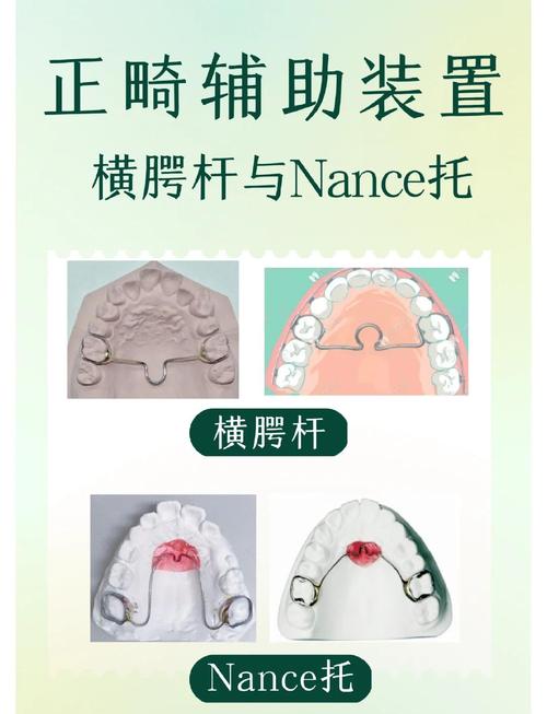 正畸时横颚杆的作用到底是什么?-图2 正畸时横颚杆的作用到底是什么?-图2