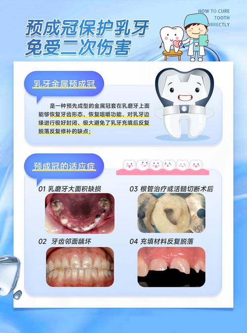 孩子龋齿严重治疗方法-图1