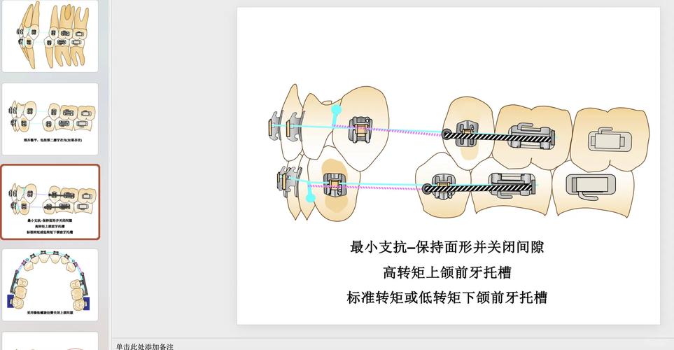 南京医科大正畸分析法-图1 南京医科大正畸分析法-图1