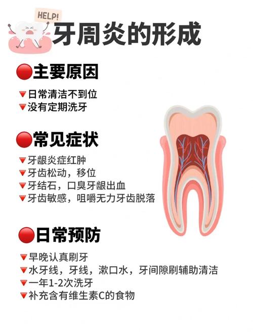 治疗牙周炎最有效方法-图3