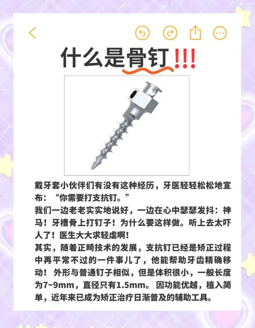 正畸二类牵引不打骨钉-图3 正畸二类牵引不打骨钉-图3