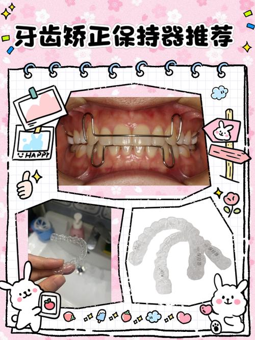 正畸弯制保持器怎么做-图1 正畸弯制保持器怎么做-图1
