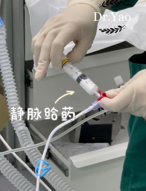 sta麻醉仪注射方法操作流程及关键要点有哪些?-图1 sta麻醉仪注射方法操作流程及关键要点有哪些?-图1