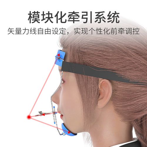 正畸前方牵引器多少钱-图2 正畸前方牵引器多少钱-图2