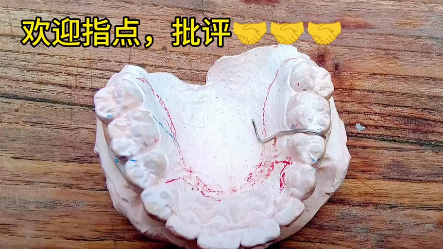 正畸邻间钩弯制的方法步骤、技巧及注意事项有哪些？-图1