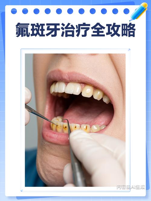 去除氟斑牙最好的方法-图3 去除氟斑牙最好的方法-图3