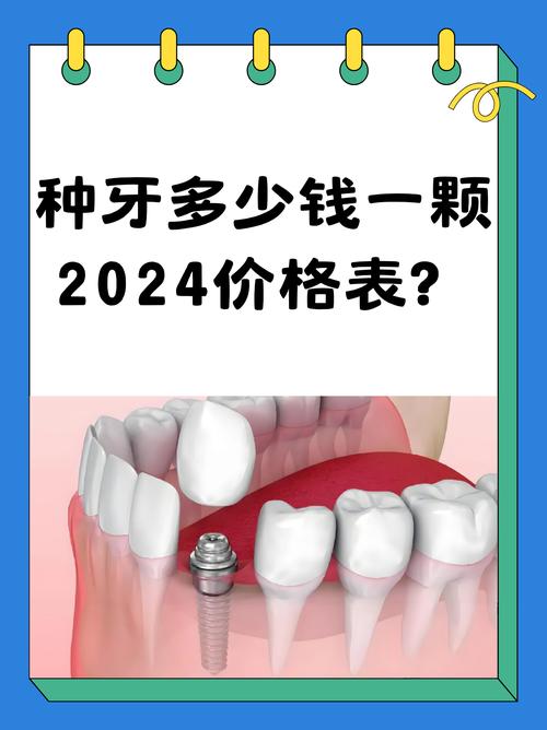 无痛微创种牙多少钱?具体价格受哪些因素影响?-图3 无痛微创种牙多少钱?具体价格受哪些因素影响?-图3