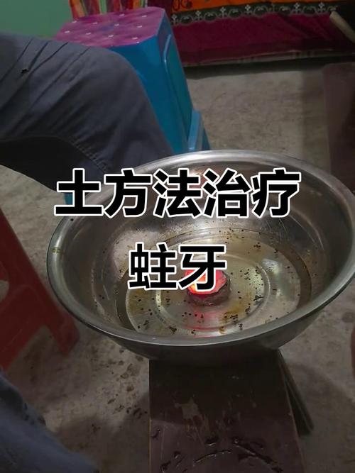 重庆虫牙怎么治疗方法-图2