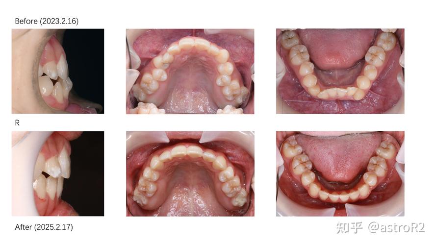 北大口腔医院正畸科刘-图1