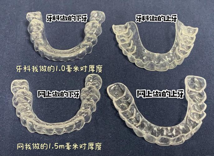 牙科正畸保持器多少钱?材质和品牌影响价格吗?-图2 牙科正畸保持器多少钱?材质和品牌影响价格吗?-图2