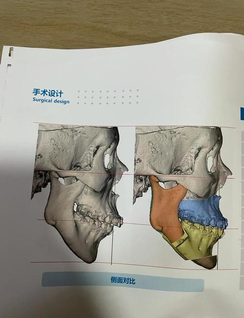 颅颌面科和正畸科区别-图2 颅颌面科和正畸科区别-图2