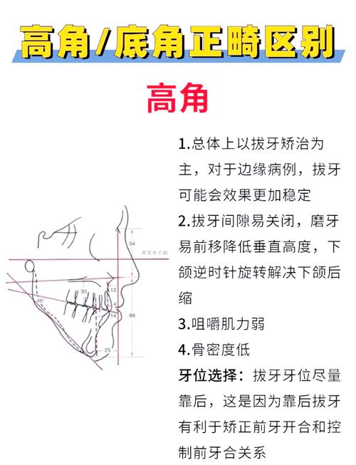 颅颌面科和正畸科区别-图1 颅颌面科和正畸科区别-图1