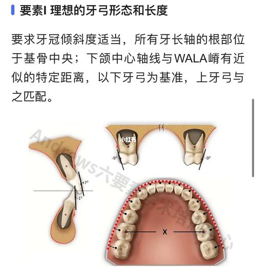 正畸软组织H线分析法在矫治中有何关键应用意义？-图3