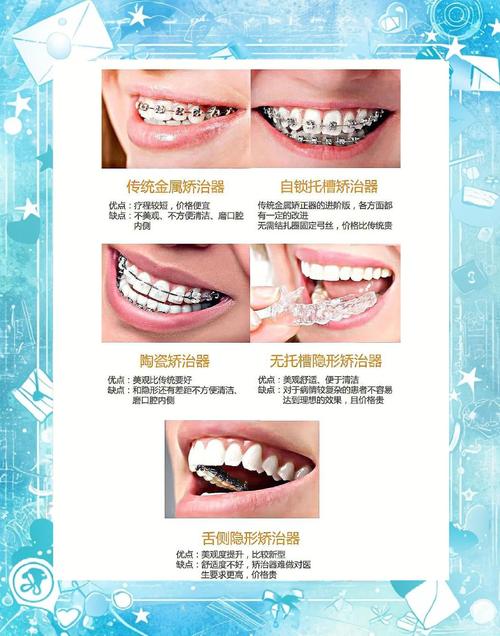 矫正器包含在正畸里吗-图3 矫正器包含在正畸里吗-图3