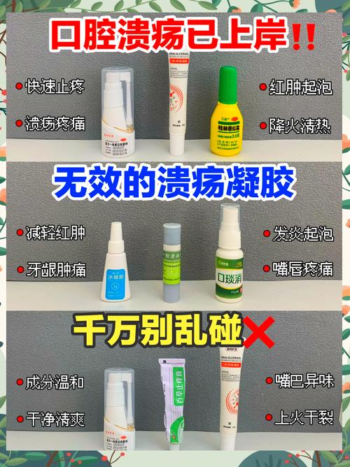 口腔溃疡反复发作总不好怎么办？快速有效治疗方法有哪些？-图3