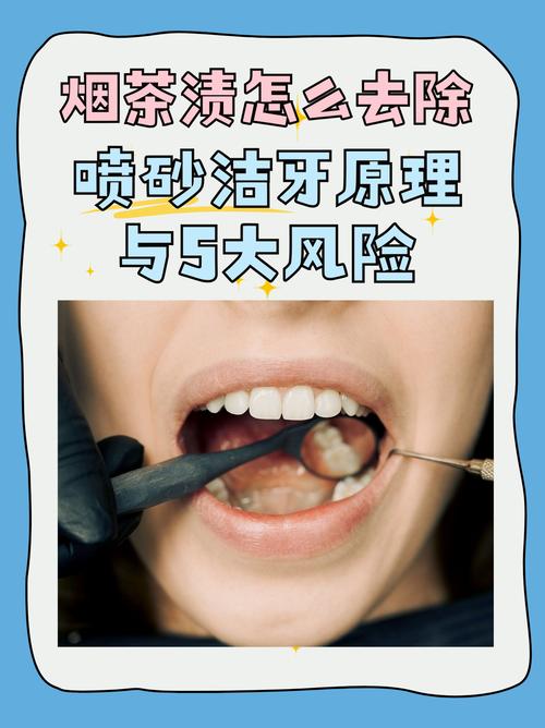 去除牙齿烟渍的好方法是什么？如何快速见效？-图1