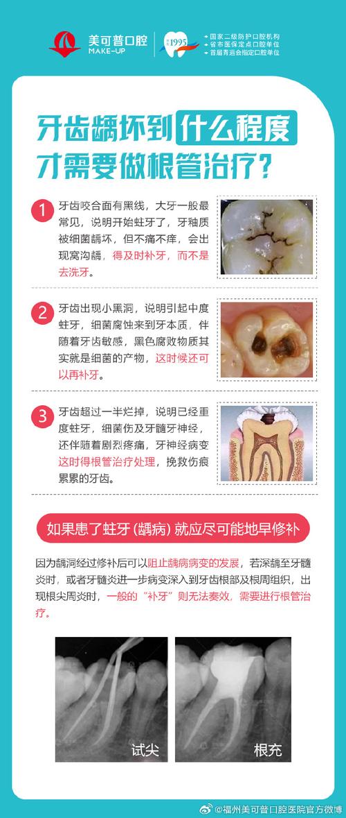 美可普口腔正畸靠谱吗-图2