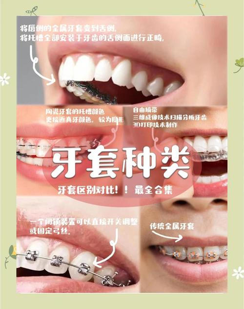 牙正畸做哪种的比较好-图1 牙正畸做哪种的比较好-图1