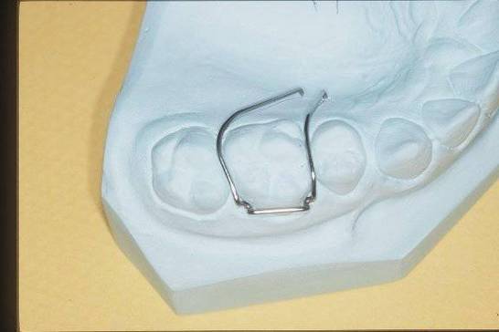 正畸单臂卡的弯制步骤-图1 正畸单臂卡的弯制步骤-图1