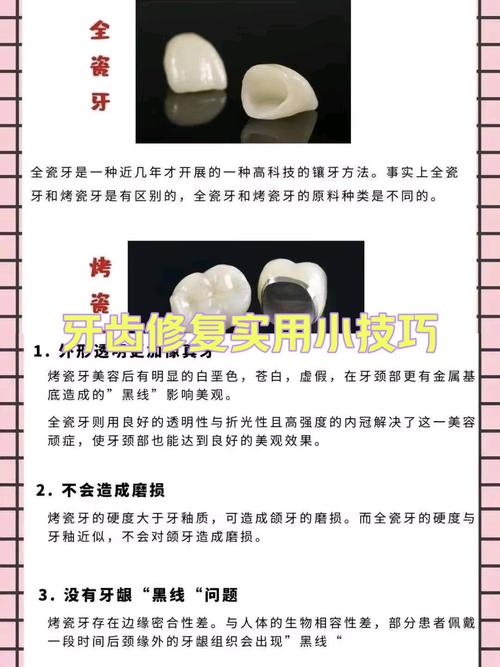 种牙与烤瓷牙的差别具体体现在哪?哪种更适合修复牙齿?-图3 种牙与烤瓷牙的差别具体体现在哪?哪种更适合修复牙齿?-图3