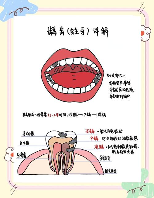 幼儿门牙龋齿治疗方法-图2 幼儿门牙龋齿治疗方法-图2