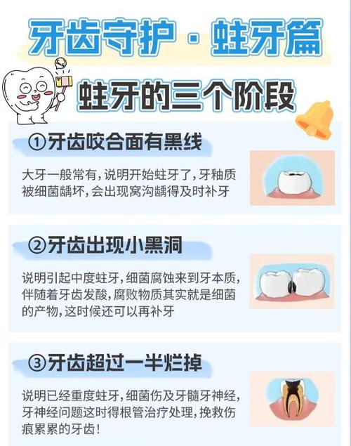 早期蛀牙有哪些治疗方法?如何有效控制病情发展?-图2 早期蛀牙有哪些治疗方法?如何有效控制病情发展?-图2