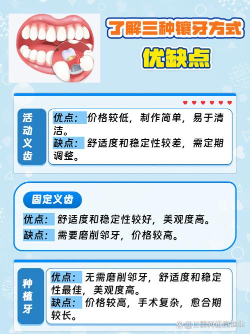 种牙和镶牙多长时间-图2