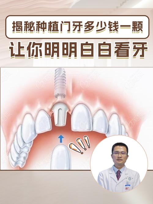 种牙应该看口腔科吗-图1 种牙应该看口腔科吗-图1