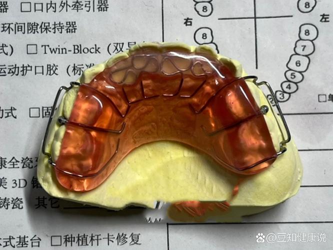 正畸反颌推簧的制作图-图3 正畸反颌推簧的制作图-图3