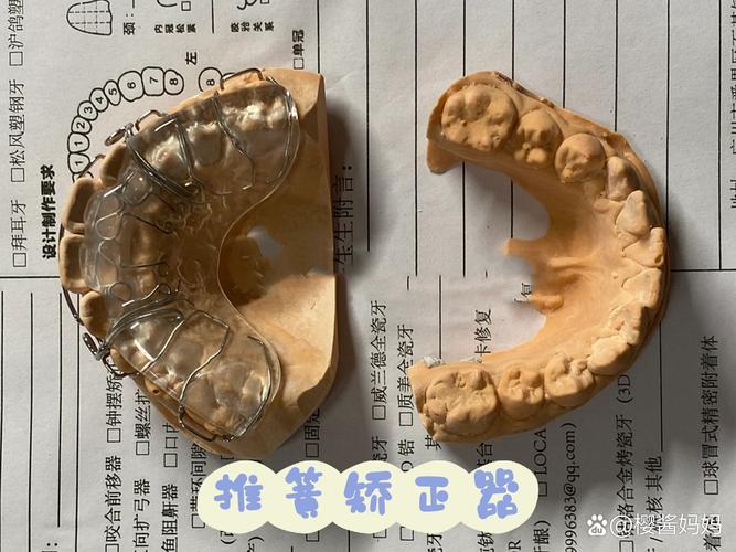 正畸反颌推簧的制作图-图1 正畸反颌推簧的制作图-图1