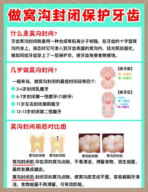宝宝龋齿怎么治疗方法-图1 宝宝龋齿怎么治疗方法-图1