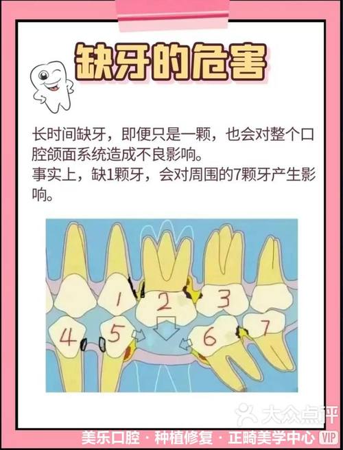 缺牙是什么感受？吃饭不便笑容尴尬，你有过吗？-图1