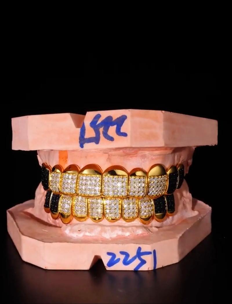 还有一种黄金叫牙金？它到底是什么来头？-图2