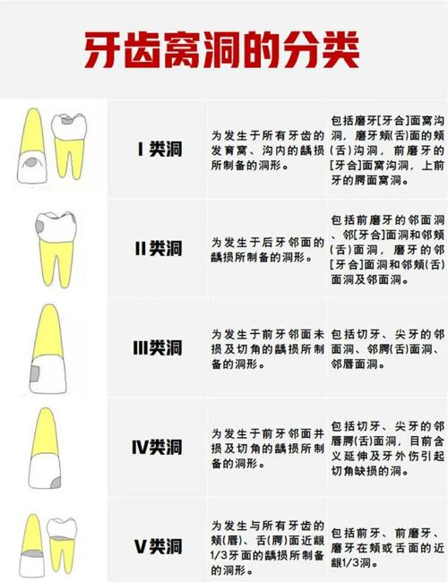 补牙的方法有几种类型-图2