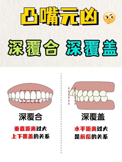 牙齿深覆合能种牙吗-图2