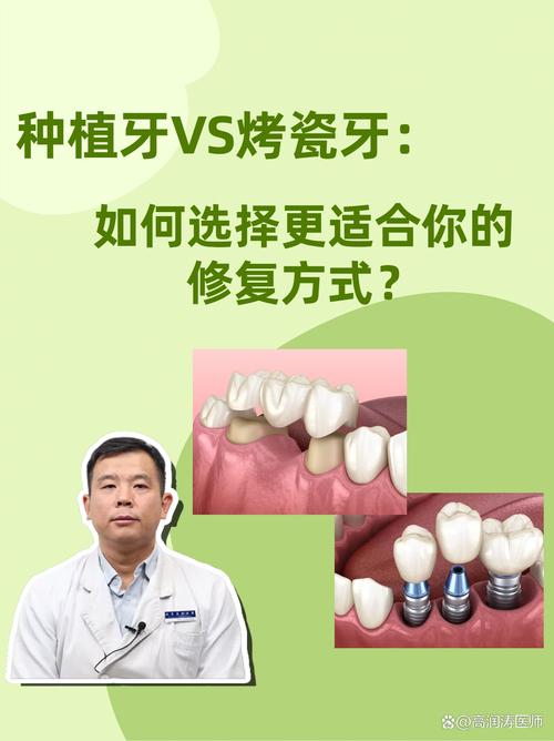 能种牙千万別烤瓷牙-图2 能种牙千万別烤瓷牙-图2