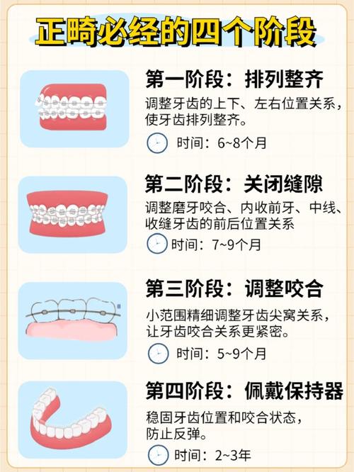 正畸推簧一般佩戴多久能见效?-图3 正畸推簧一般佩戴多久能见效?-图3