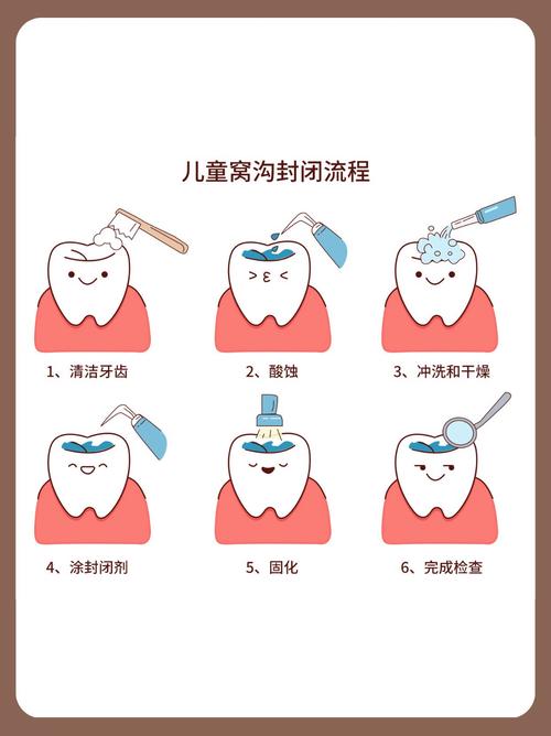 正畸期间，窝沟封闭到底用不用做？-图1