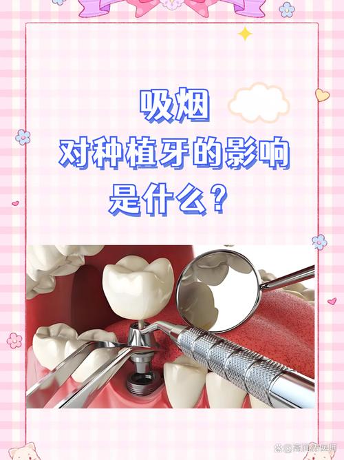 刚种完牙后吸烟可以吗？会对种植牙恢复造成影响吗？-图2