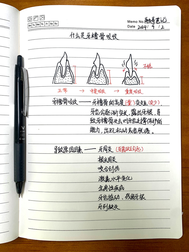 升牙槽骨有几种方法-图2